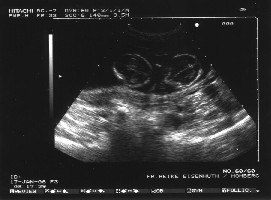 US-Bild vom 17.01.2006