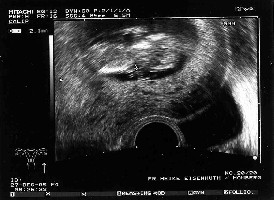 US-Bild vom 27.12.2005