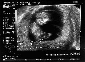 US-Bild vom 27.12.2005