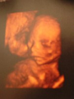 Maja´s kleine Schwester.jpg