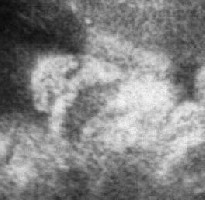 Ein Ausschnittt von unser Maus mit Nase und Mund :-)