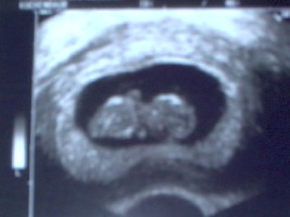 letztes US-Bild vom 27.März