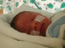 Marlon (zu Zeit noch mit Magen- und O2-Sonde)