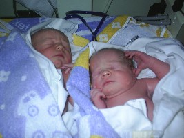 Direkt nach der Geburt