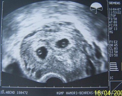 1. US Gruppenbild test.JPG