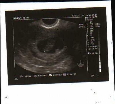 unser krümmel in der 9. woche