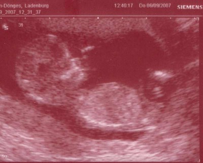 Knödel  SSW12+6.jpg