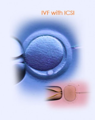 ICSI Bild 4.jpg