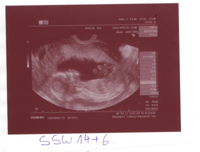 Knödel  SSW 14+6.JPG