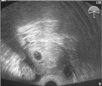 US 2007-11-01 - 5+6 klein.jpg