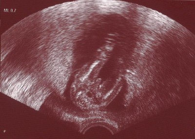 Baby 15+6 - 2 klein.JPG