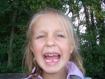 1. Zahnlücke 24.08.08