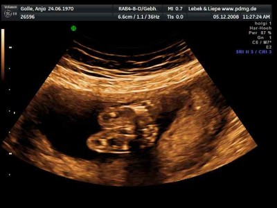 zeigt her eure Füße.jpg