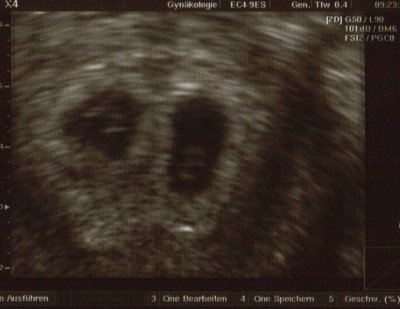 18.09.2009 13;54;58.jpg