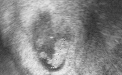 US12_11_9SSW4 komprimiert.jpg