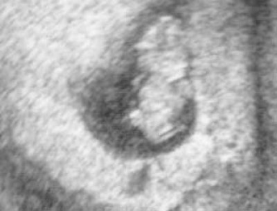 US_12_11_9_SSW komprimiert.jpg