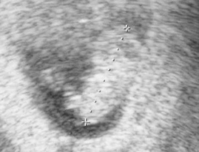 US_12_11_9SSW3 komprimiert.jpg