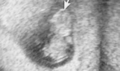 US_12_11_9SSW2 komprimiert.jpg