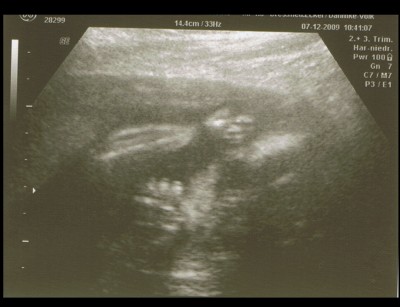 Unser Daumenlutscher ;)