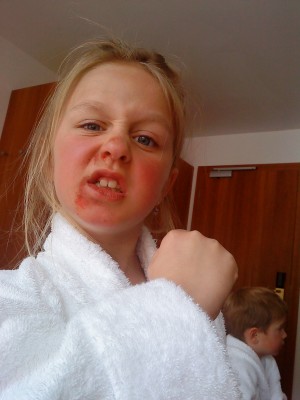 ...der Andere sieht schlimmer aus...