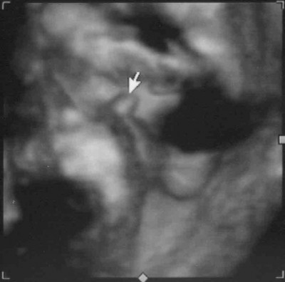 US 07.04.10 29+2 SSW 2 komprimiert.jpg