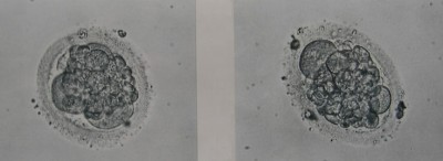 Wie würden sie die Embryonen beurteilen?<br /><br />Vielen Dank im Voraus :-)<br />Jessie74