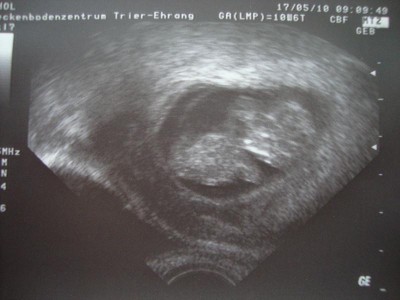 US Bild 20.05.2010 004kl.jpg