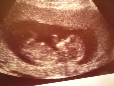 17.06.2010 12+1 forum.jpg