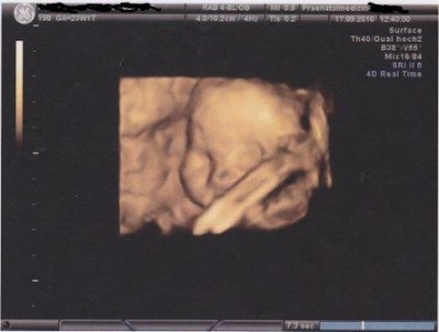 Unser Sohn bei 23+1 am 17.09.2010