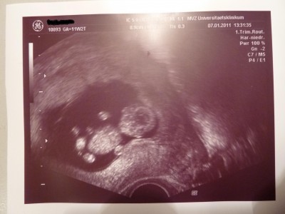 07.01.11 11+2 (1) kleinputz.jpg