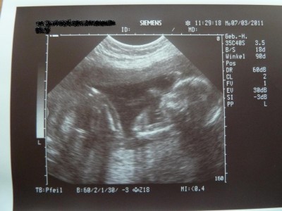 15 07.03.2011 19+5.JPG