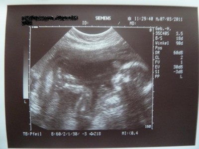 14 07.03.2011 19+5.JPG