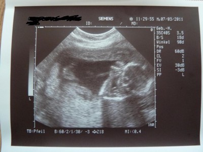 13 07.03.2011 19+5.JPG