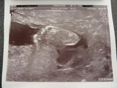 17 10.03.2011 20+1.JPG