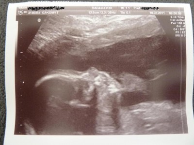 16 10.03.2011 20+1.JPG