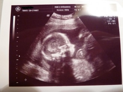 18 22.03.2011 21+6.JPG