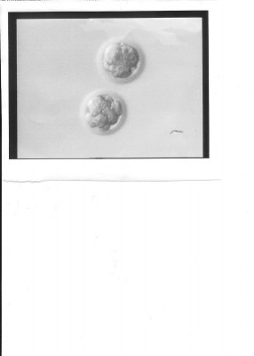 Scan_Embryo.jpg