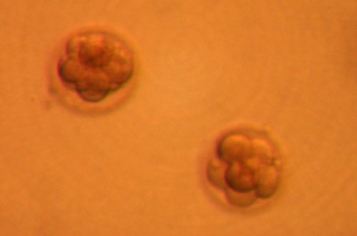 Bild bearbeitet - Kontrast erhöht