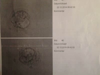 Fotos der Embryonen pu+5