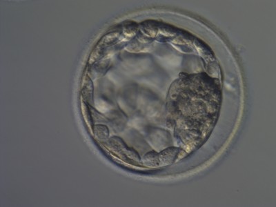 expandierte BC 1215 jpeg.jpg