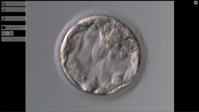 expandierte BC 0116 Kryo2.jpg