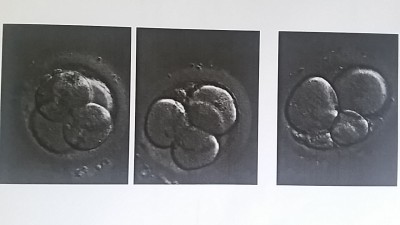 Embryos
