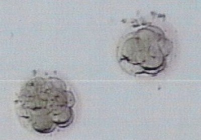 Embryonen Mai 2016 Ausschnitt.jpg