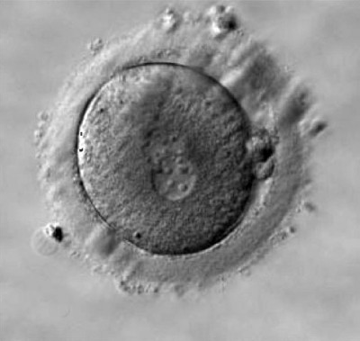 Human_zygote_two_pronuclei_03.jpg