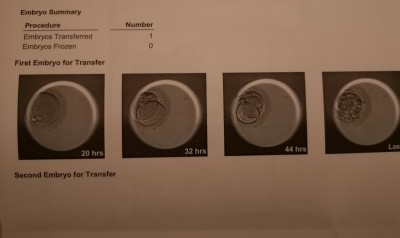 Embryoscope Bild.jpg